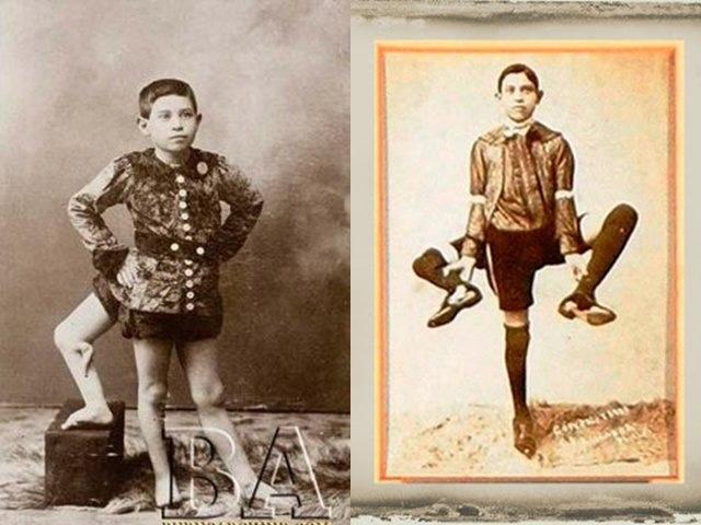 Francesco Lentini: Overcoming Challenges